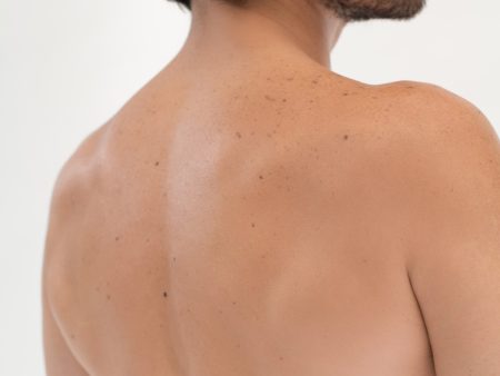 Espalda y cuello posterior masculino | Depilación Láser For Discount