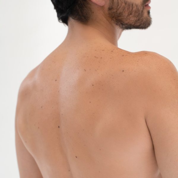 Espalda y cuello posterior masculino | Depilación Láser For Discount